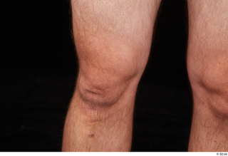 Louis knee nude 0004.jpg